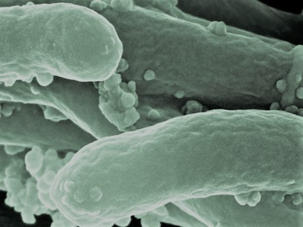Detailed capture of Mycrobacterium tuberculosis