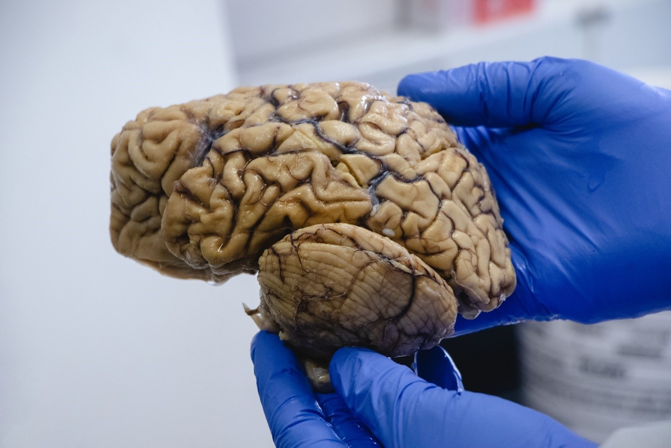 Brain preserved in the UdeA neurobank